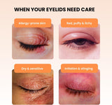 BLEPHADERM Eyelid Cream